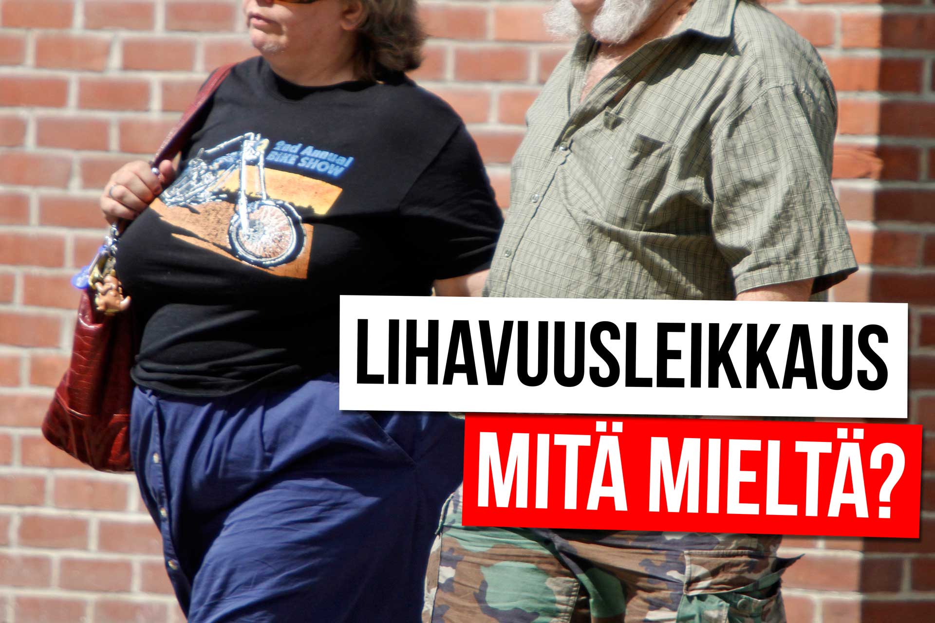 Lihavuusleikkaus – mahalaukun ohitusleikkaus