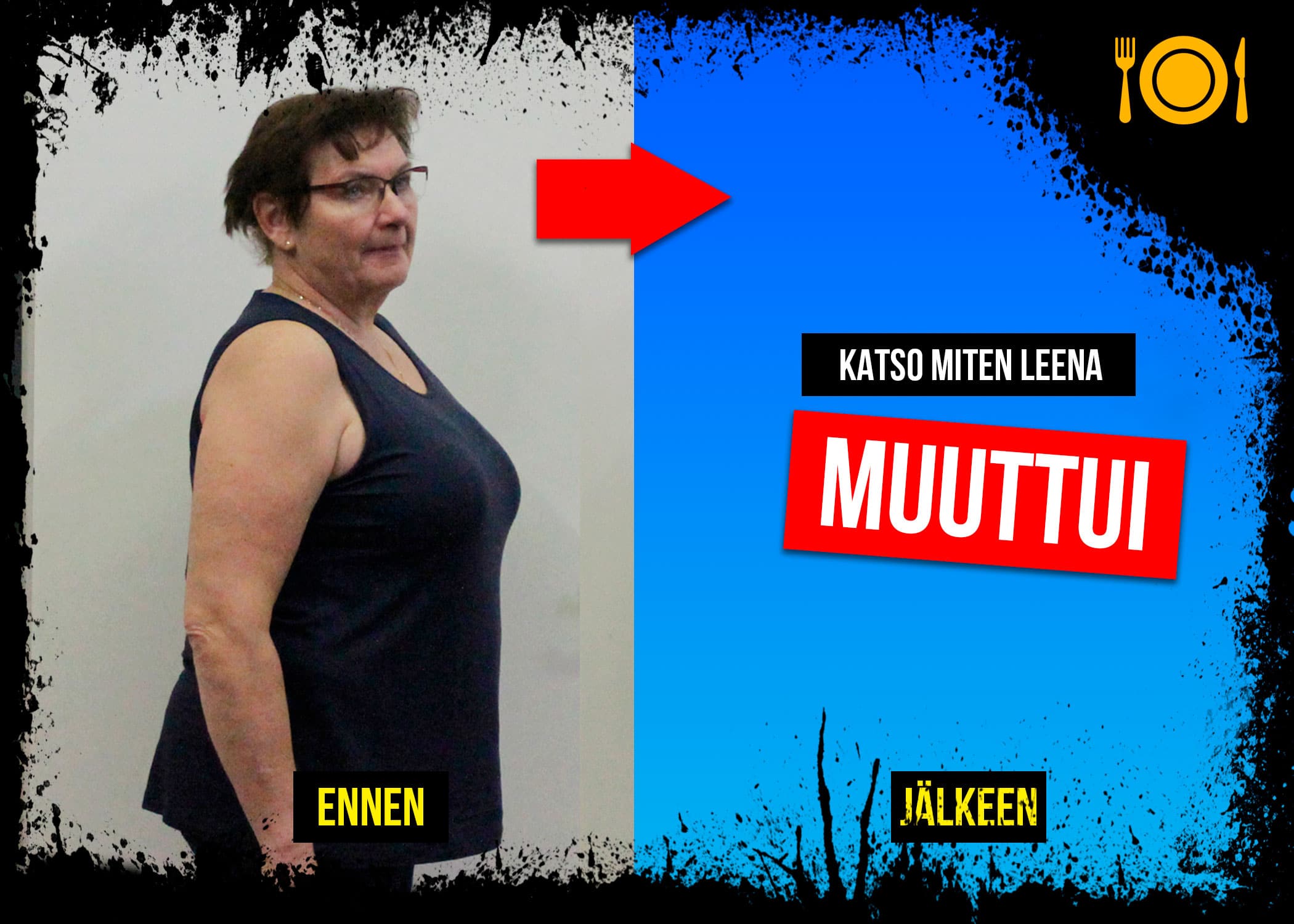 59-vuotias nainen välttää kirurgin veitsen